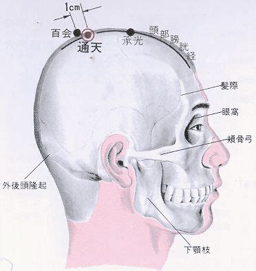 陽光穴|醫砭 » 經穴庫 » 承光